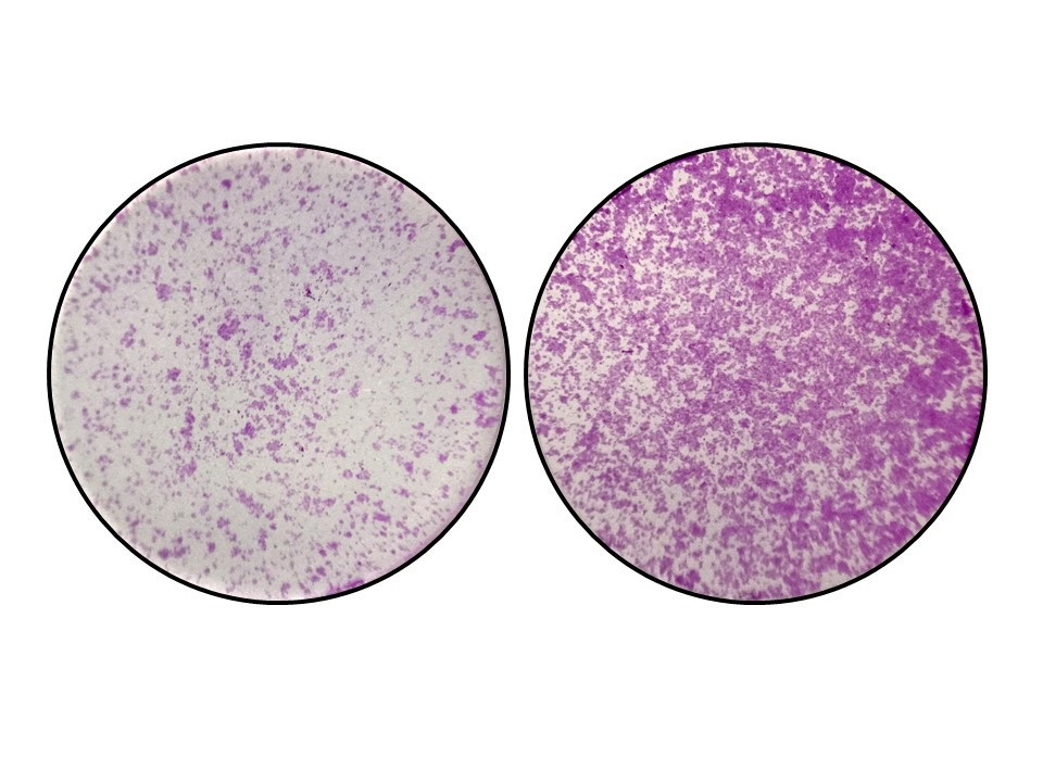 En la izquierda, se observan células del colon con niveles normales de TYW2 y la pieza “Y”. En la derecha, cuando sucede la perdida de TYW2 y el nucleótido “Y”, las células del cáncer de c