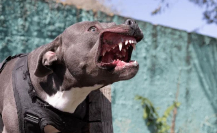 Un pitbull rabioso le arranca el brazo a su dueña en un brutal ataque