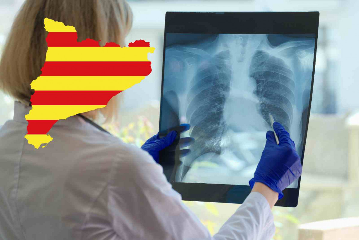 Tuberculosis, Catalunya