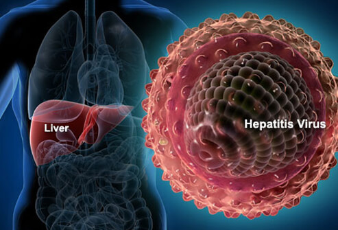 Hepatitiss1liverhepatitisvirus